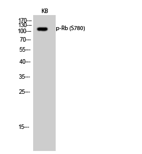 Phospho-Rb (Ser780) Rabbit pAb ABZ4475