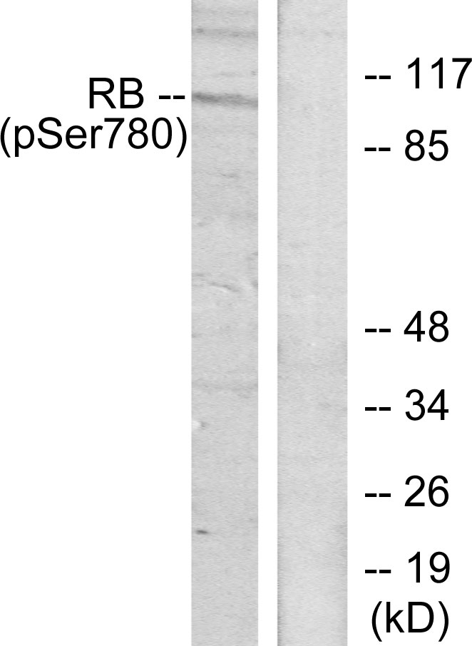 Phospho-Rb (Ser780) Rabbit pAb ABZ4475