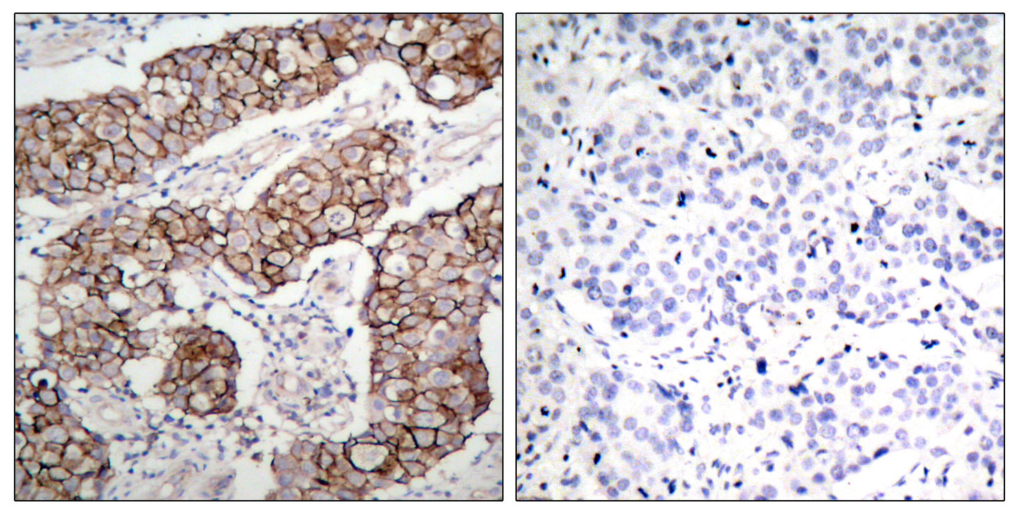 Phospho-EGFR (Tyr1092) Rabbit pAb ABZ4476