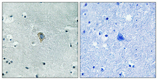 Phospho-kappa Opioid Receptor (Ser369) Rabbit pAb ABZ4478