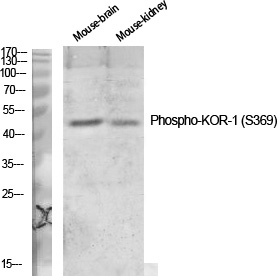 Phospho-kappa Opioid Receptor (Ser369) Rabbit pAb ABZ4478