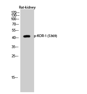 Phospho-kappa Opioid Receptor (Ser369) Rabbit pAb ABZ4478
