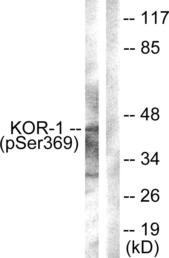 Phospho-kappa Opioid Receptor (Ser369) Rabbit pAb ABZ4478