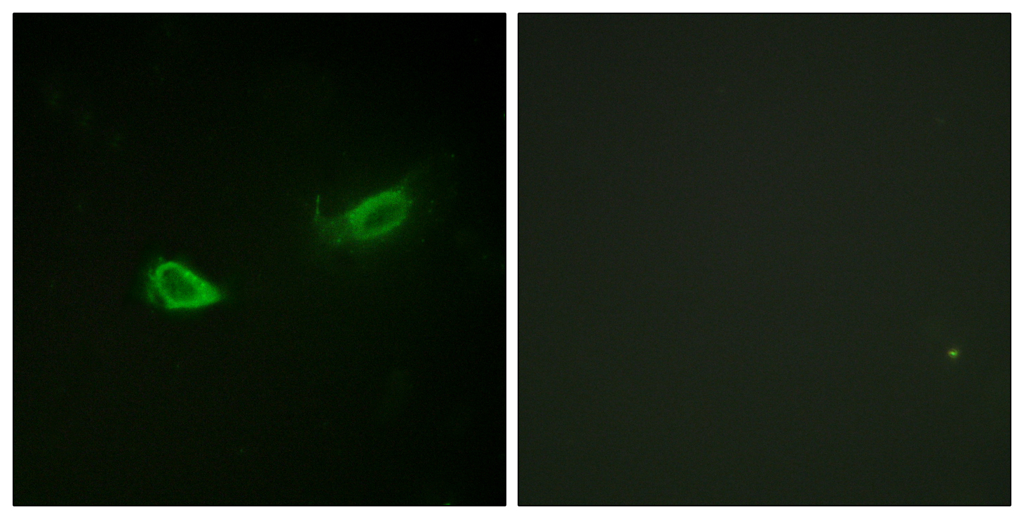 Phospho-Sodium Potassium ATPase (Ser23) Rabbit pAb ABZ4479