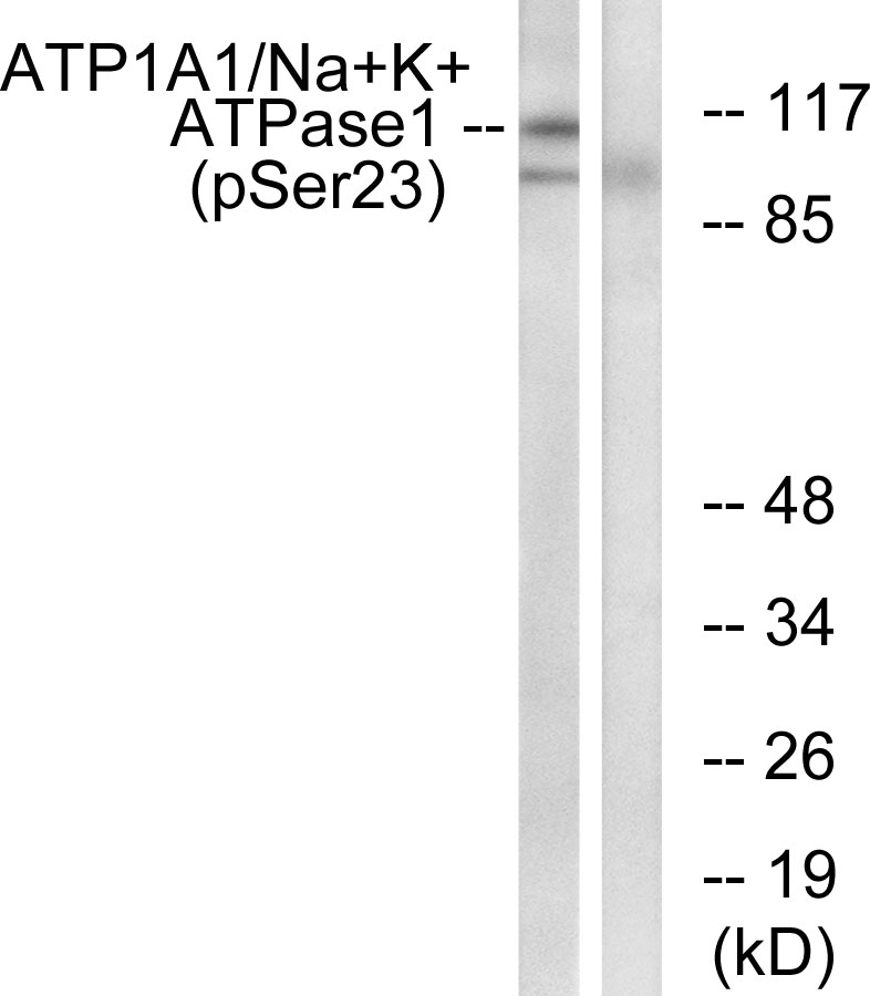 Phospho-Sodium Potassium ATPase (Ser23) Rabbit pAb ABZ4479
