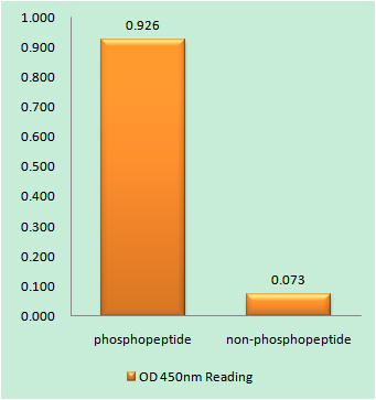 Phospho-Cardiac Troponin I (Ser22/Ser23) Rabbit pAb ABZ4480