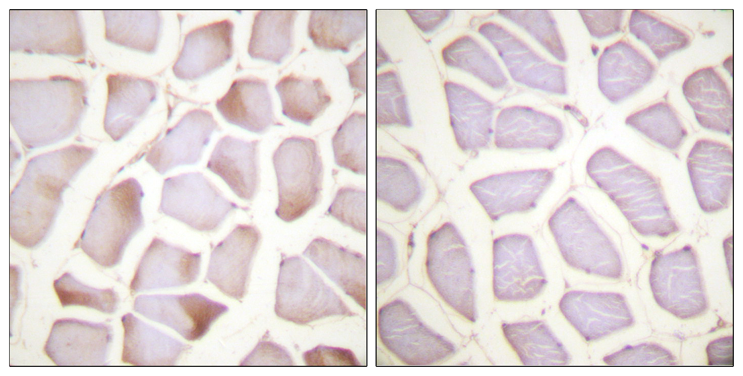 Phospho-Cardiac Troponin I (Ser22/Ser23) Rabbit pAb ABZ4480