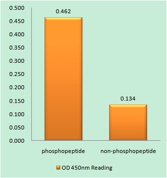 Phospho-IKK beta (Tyr188) Rabbit pAb ABZ4481