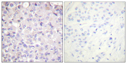 Phospho-IKK beta (Tyr188) Rabbit pAb ABZ4481