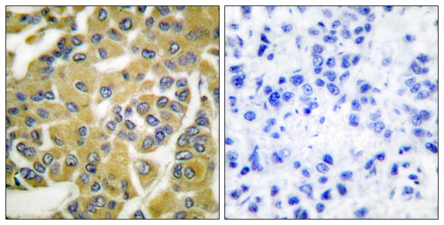 Phospho-IKK beta (Tyr188) Rabbit pAb ABZ4481