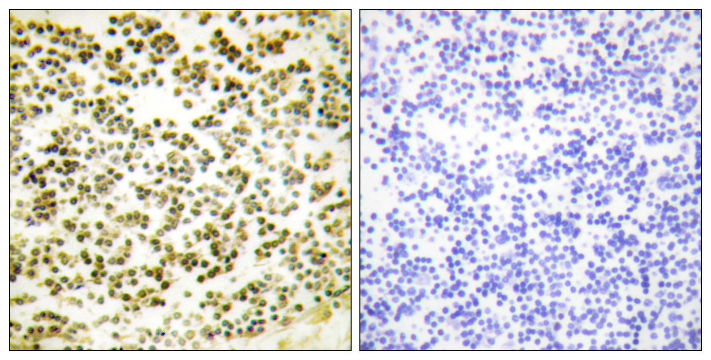 Phospho-p107 (Thr369) Rabbit pAb ABZ4482