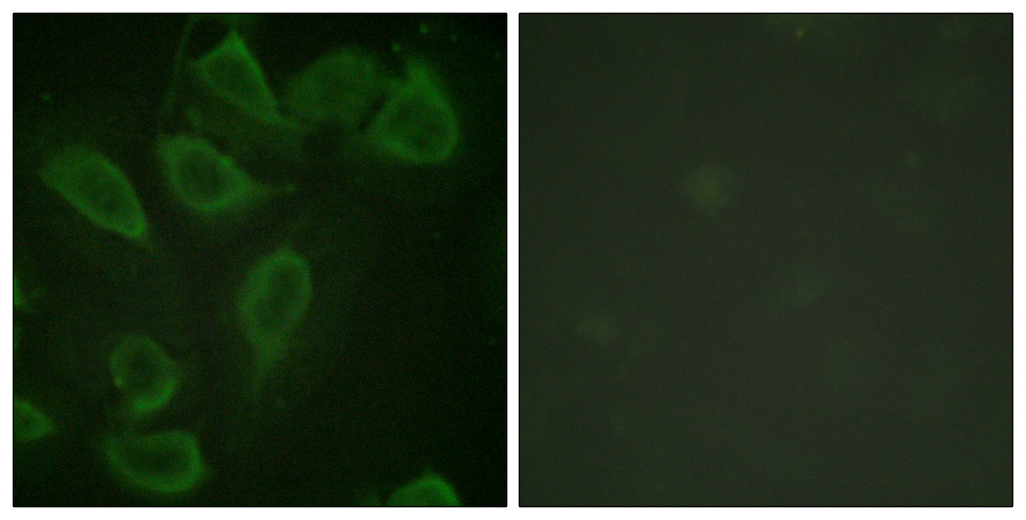 Phospho-CD31 (Tyr713) Rabbit pAb ABZ4483