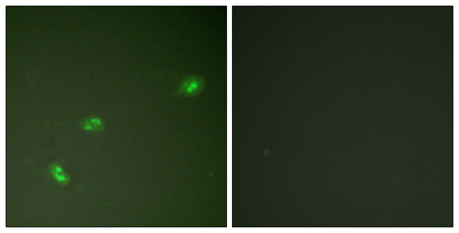 Phospho-Nucleophosmin (Thr199) Rabbit pAb ABZ4484