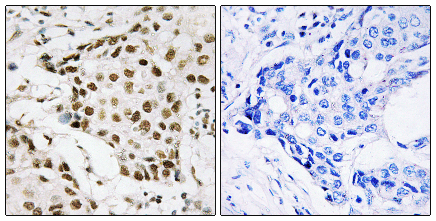 Phospho-Nucleophosmin (Thr199) Rabbit pAb ABZ4484