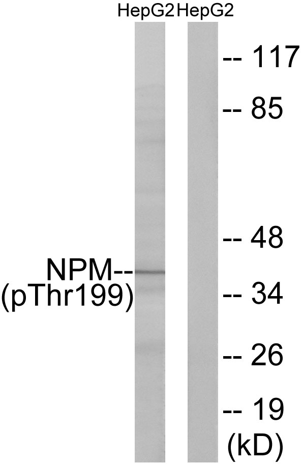 Phospho-Nucleophosmin (Thr199) Rabbit pAb ABZ4484