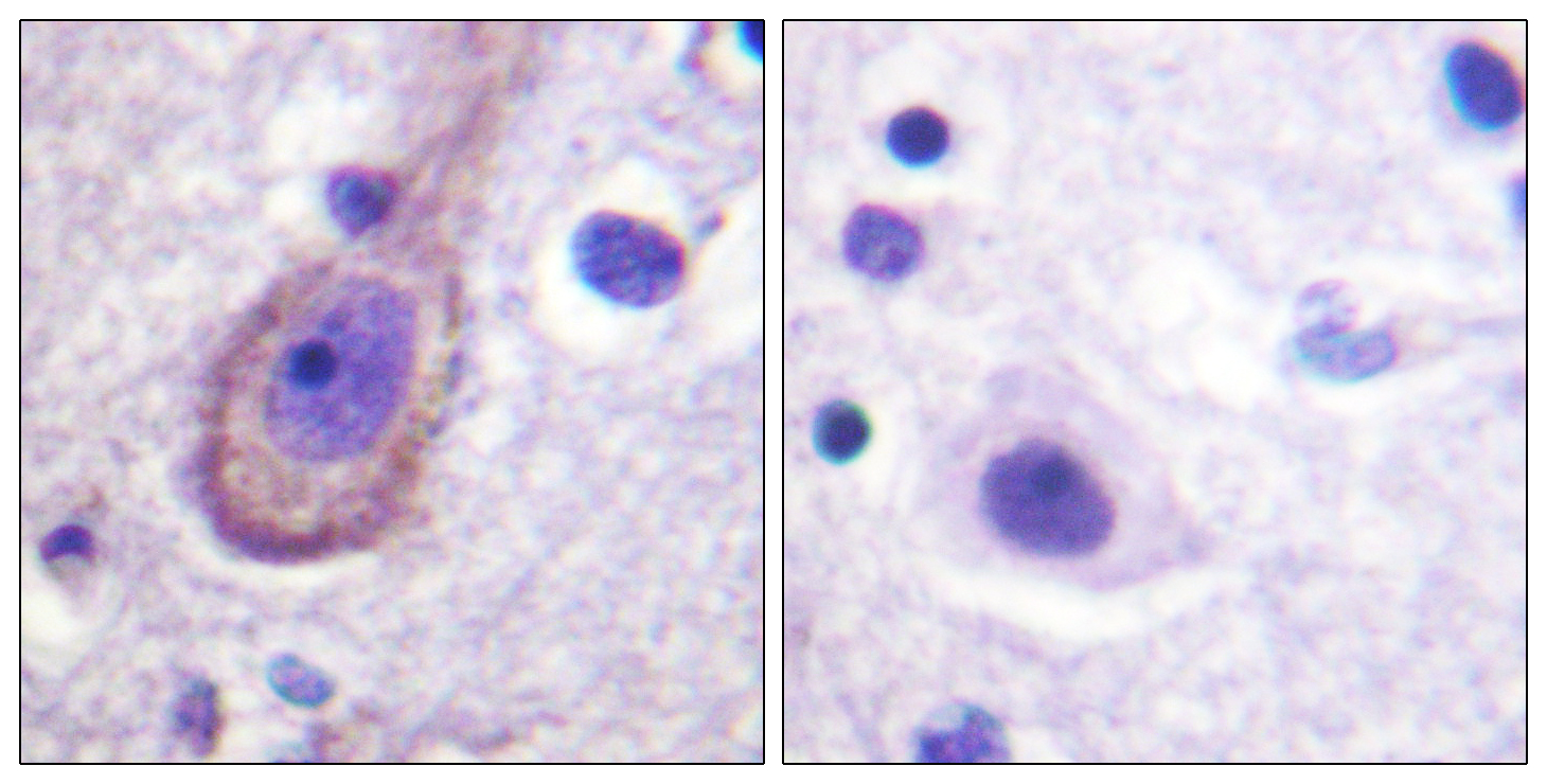 Phospho-KCNQ2/3/4/5 (Thr217/Thr246/Thr223/Thr251) Rabbit pAb ABZ4485