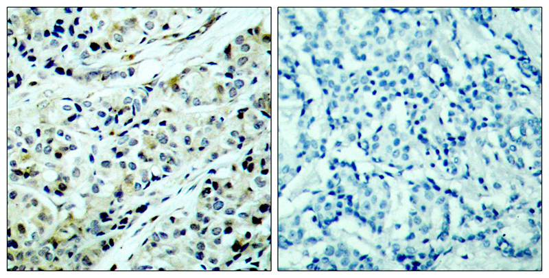 Phospho-HDAC5 (Ser498) Rabbit pAb ABZ4490