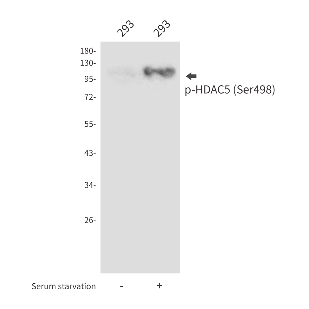 Phospho-HDAC5 (Ser498) Rabbit pAb ABZ4490