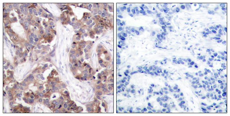 Phospho-Stathmin 1 (Ser25) Rabbit pAb ABZ4491