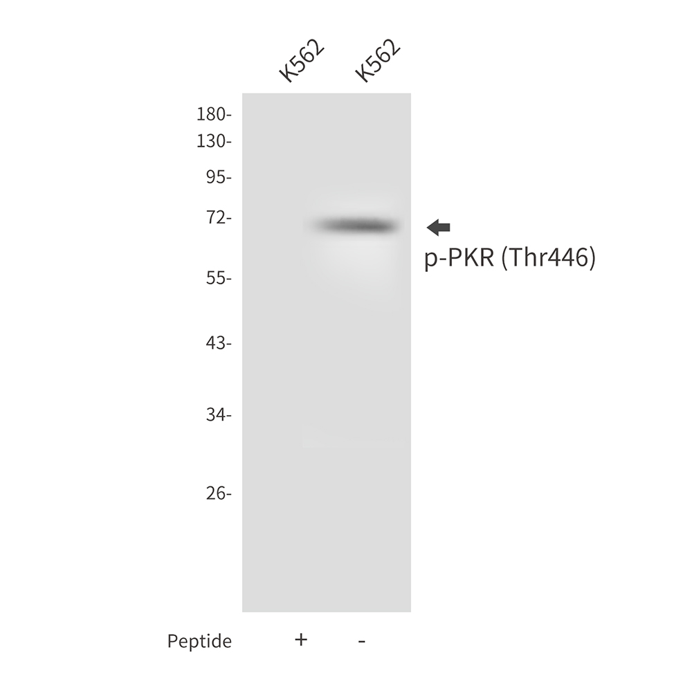 Phospho-PKR (Thr446) Rabbit pAb ABZ4492