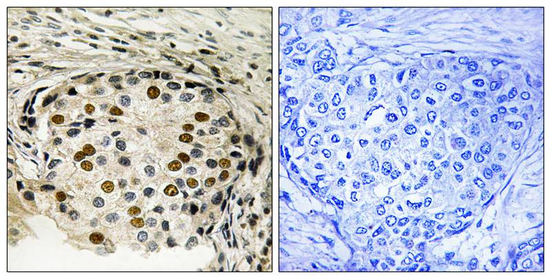 Phospho-OXSR1 (Thr185) Rabbit pAb ABZ4494