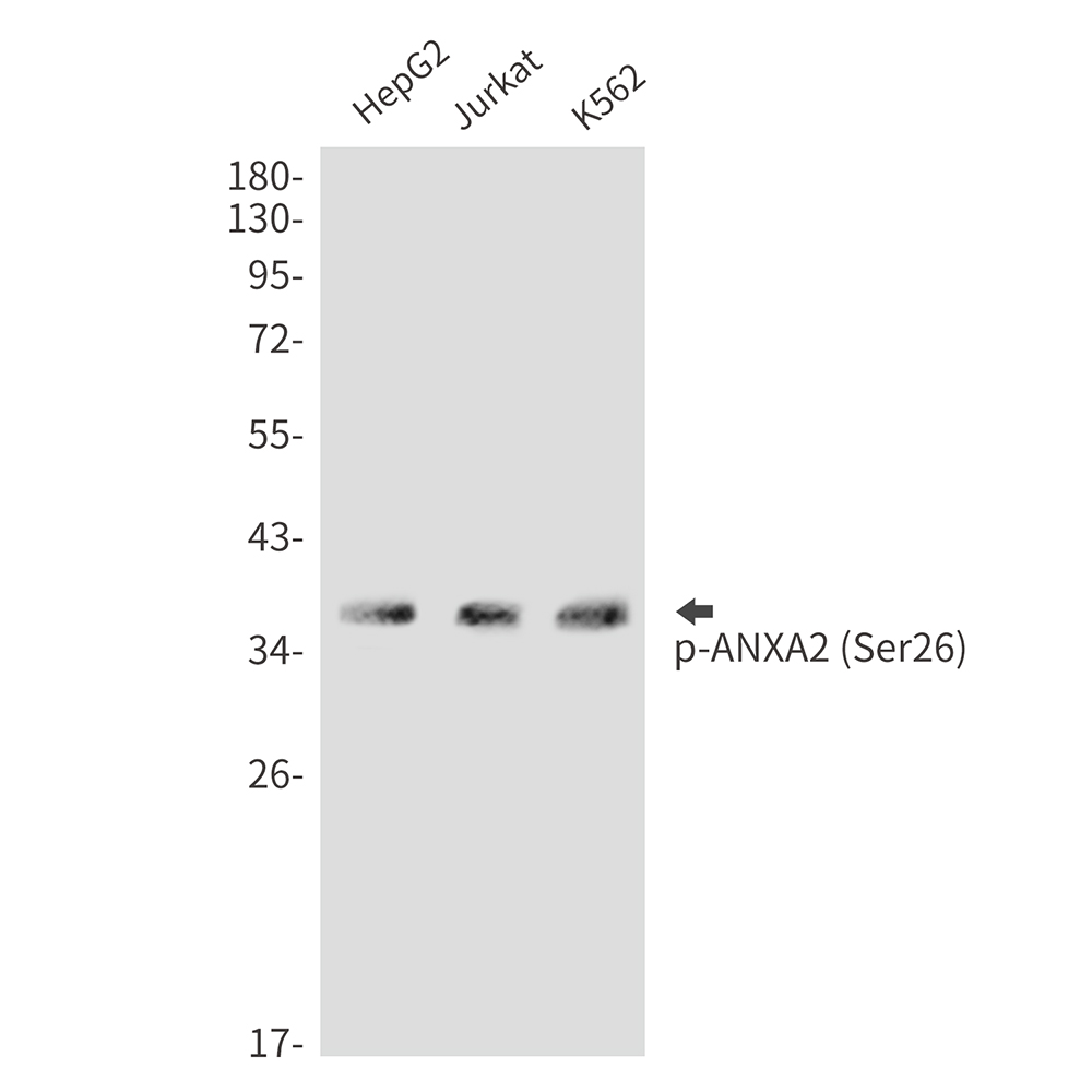 Phospho-Annexin 2 (Ser26) Rabbit pAb ABZ4499