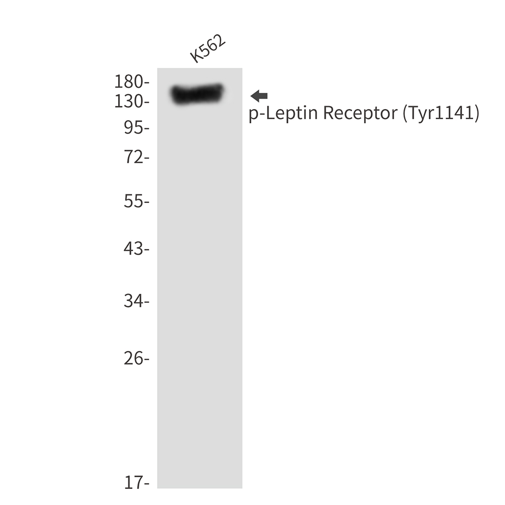 Phospho-Leptin Receptor (Tyr1141) Rabbit pAb ABZ4505