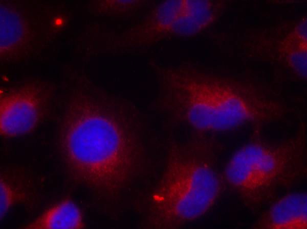 Phospho-PTEN (Ser380) Rabbit pAb ABZ4506