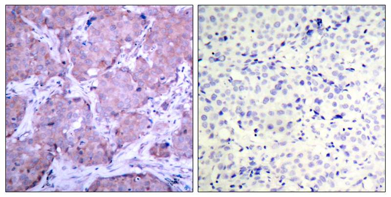 Phospho-PTEN (Ser380) Rabbit pAb ABZ4506