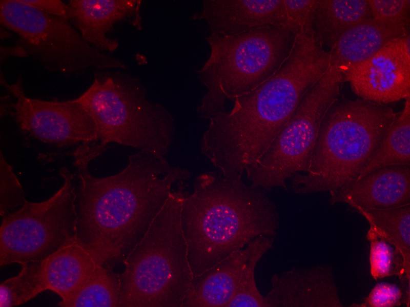 Phospho-ER alpha (Ser167) Rabbit pAb ABZ4508