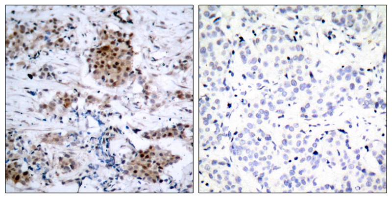 Phospho-ER alpha (Ser167) Rabbit pAb ABZ4508