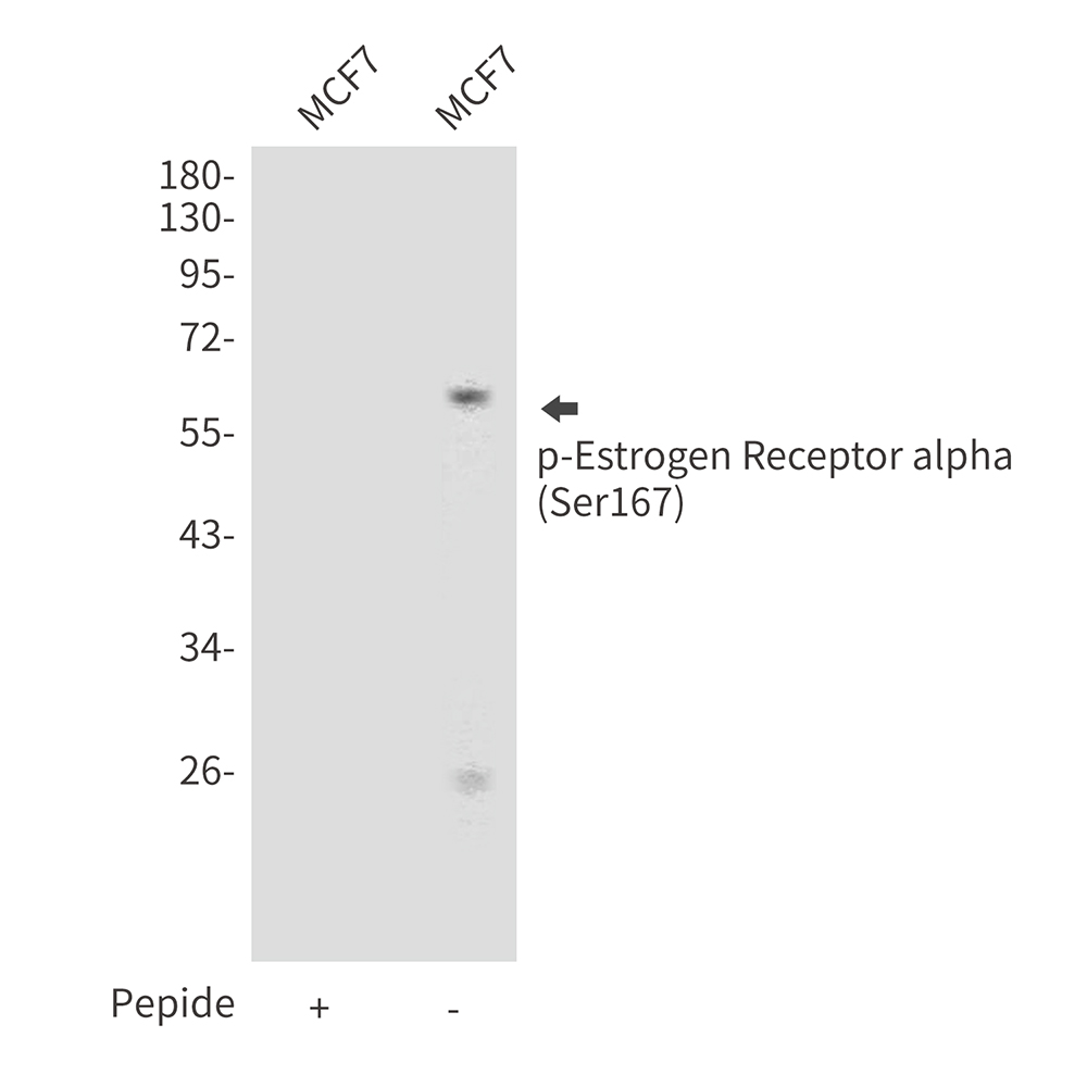Phospho-ER alpha (Ser167) Rabbit pAb ABZ4508