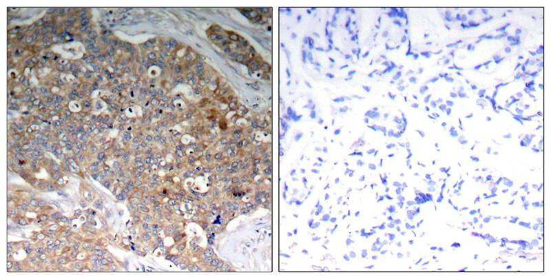 Phospho-GSK3(alpha + beta)(Tyr279/Tyr216) Rabbit pAb ABZ4509