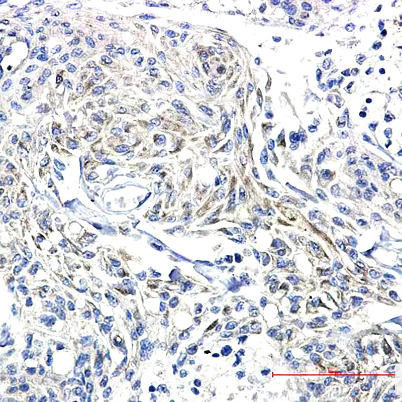 Phospho-Synapsin I (Ser9) Rabbit mAb ABZ4510