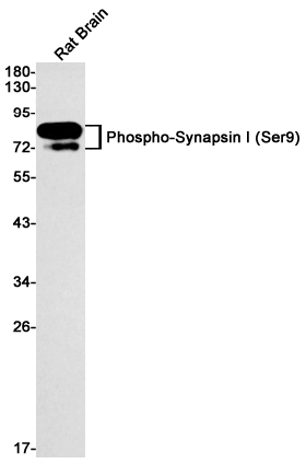 Phospho-Synapsin I (Ser9) Rabbit mAb ABZ4510