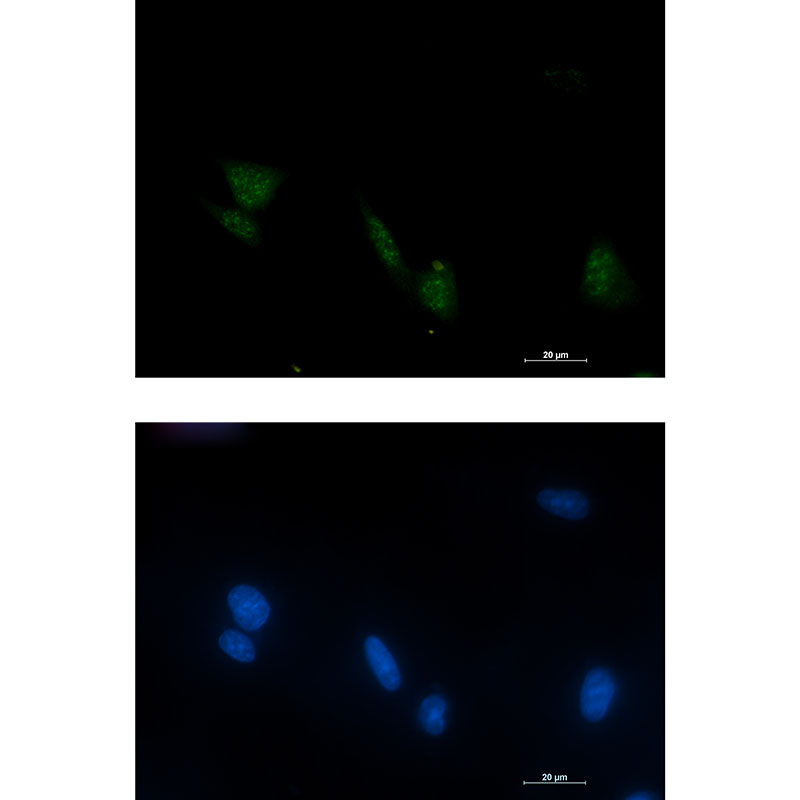 Phospho-RSK4 (Ser232) Rabbit mAb ABZ4511