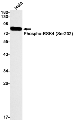 Phospho-RSK4 (Ser232) Rabbit mAb ABZ4511