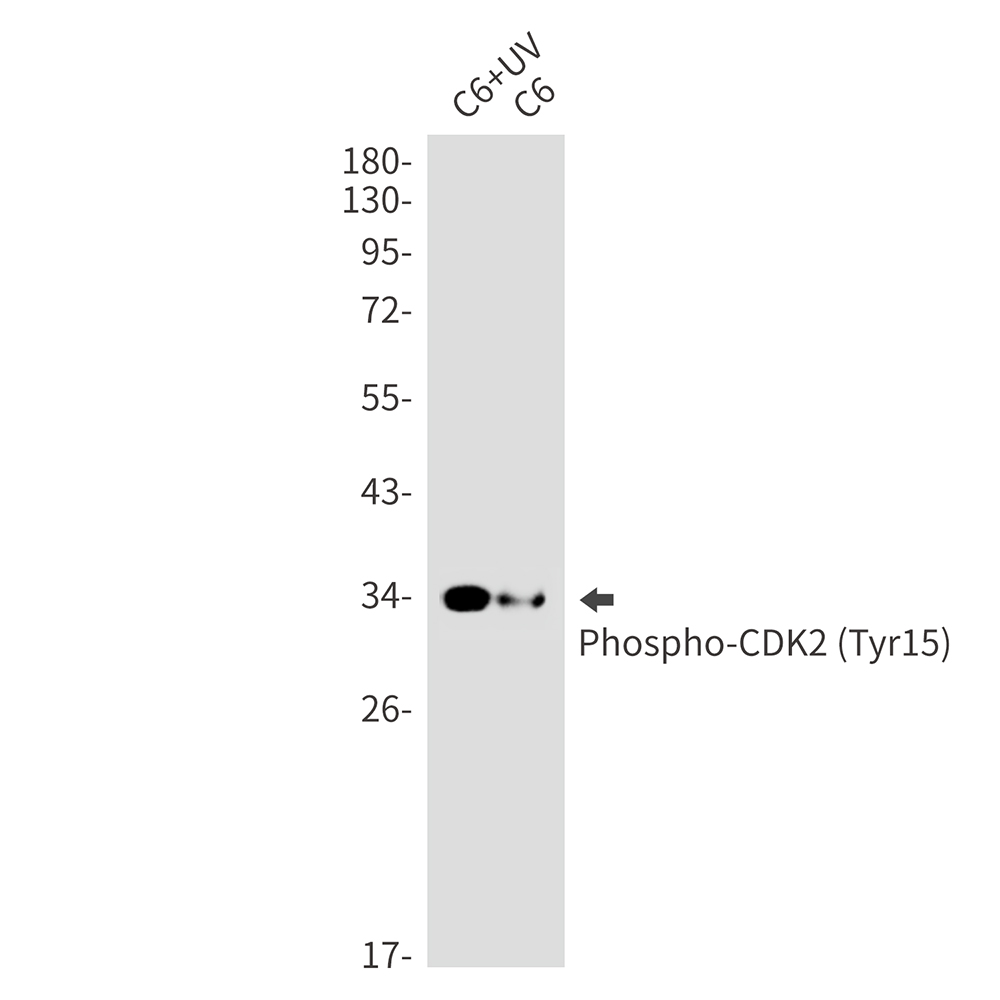 Phospho-CDK2 (Tyr15) Rabbit mAb ABZ4512