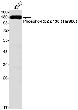 Phospho-Rb2 p130 (Thr986) Rabbit mAb ABZ4513