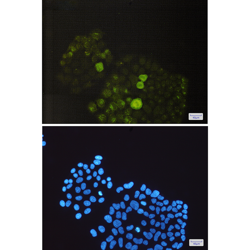Phospho-PTP1B (Ser352) Rabbit mAb ABZ4514