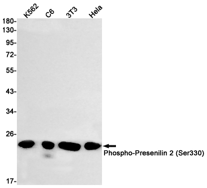 Phospho-Presenilin 2/AD5 (Ser330) Rabbit mAb ABZ4515