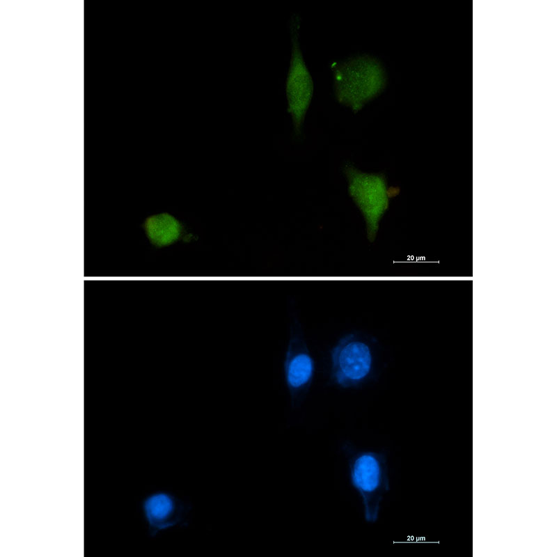 Phospho-delta 1 Catenin (Tyr228) Rabbit mAb ABZ4516