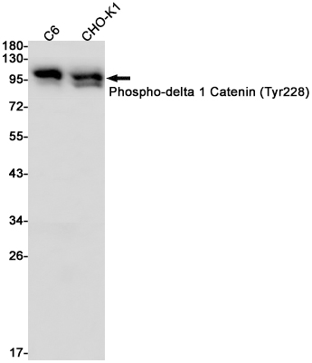 Phospho-delta 1 Catenin (Tyr228) Rabbit mAb ABZ4516
