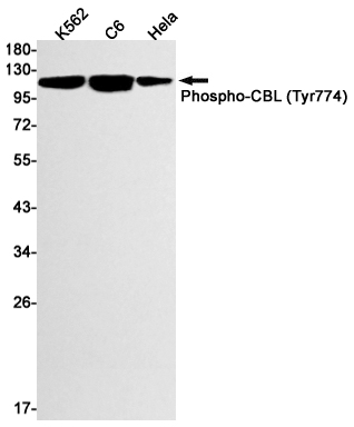 Phospho-CBL (Tyr774) Rabbit mAb ABZ4518