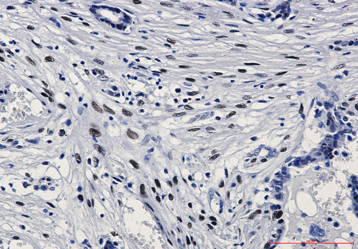 Phospho-c-Jun (Ser63) Rabbit mAb ABZ4520