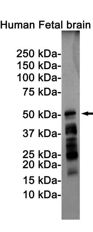 Phospho-Tau (Ser198) Rabbit mAb ABZ4521