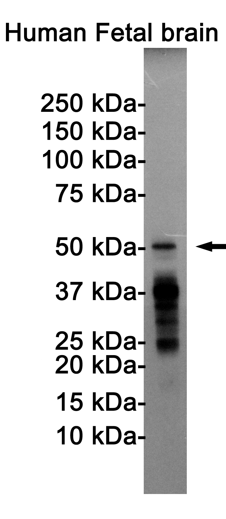 Phospho-Tau (Thr205) Rabbit mAb ABZ4523