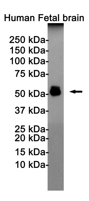 Phospho-Tau (Thr181) Rabbit mAb ABZ4525