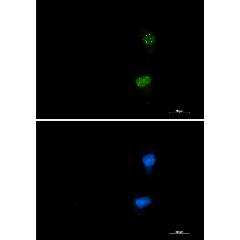 Phospho-ATF2 (Thr71) Rabbit mAb ABZ4526