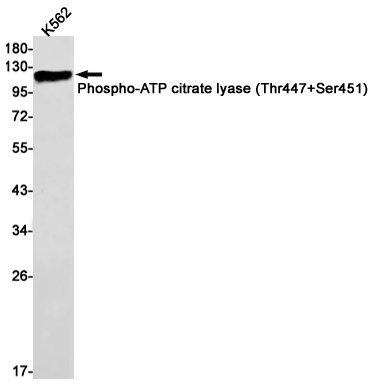 Phospho-ATP Citrate Synthase (Thr447/Ser451) Rabbit mAb ABZ4527